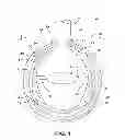 Fig. 02 - Interior bag for a capsular bag and injector