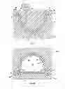 Fig. 02 - External breast prosthesis