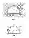 Fig. 03 - External breast prosthesis