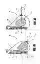 Fig. 02 - NONAUGMENTIVE MASTOPEXY