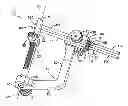 Fig. 01 - Method and apparatus for fixing a graft in a bone tunnel