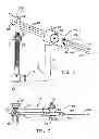 Fig. 06 - Method and apparatus for fixing a graft in a bone tunnel