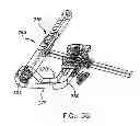 Fig. 35 - Method and apparatus for fixing a graft in a bone tunnel