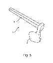 Fig. 07 - Facet joint replacement