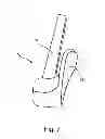 Fig. 09 - Facet joint replacement