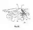 Fig. 28 - Facet joint replacement