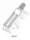 Fig. 32 - Facet joint replacement