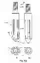 Fig. 33 - Facet joint replacement