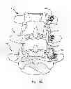 Fig. 37 - Facet joint replacement
