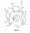 Fig. 47 - Facet joint replacement
