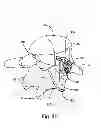 Fig. 48 - Facet joint replacement