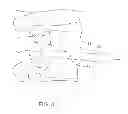 Fig. 04 - Spinal stabilization system and method