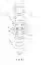 Fig. 13 - Spinal stabilization system and method