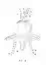 Fig. 15 - Spinal stabilization system and method