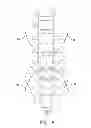 Fig. 16 - Spinal stabilization system and method