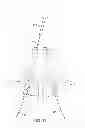 Fig. 24 - Spinal stabilization system and method