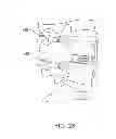 Fig. 29 - Spinal stabilization system and method