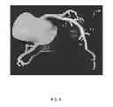 Fig. 06 - Method and system for providing information from a patient-specific model of blood flow