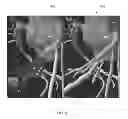 Fig. 07 - Method and system for providing information from a patient-specific model of blood flow