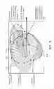 Fig. 15 - Lens heating compensation systems and methods