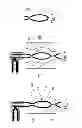 Fig. 05 - Method for producing a toothbrush handle having an inner cavity