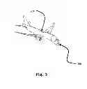 Fig. 04 - Household vacuum cleaner attachment