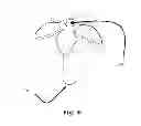 Fig. 05 - Household vacuum cleaner attachment