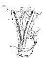 Fig. 01 - Modified Boot