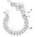Fig. 01 - Jewelry enhancer