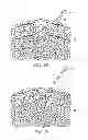 Fig. 07 - Device and Method for Repairing a Knitted Article