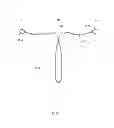 Fig. 02 - Intrauterine contraceptive device