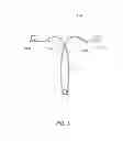 Fig. 06 - Intrauterine contraceptive device