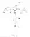 Fig. 06 - Intrauterine contraceptive device
