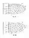 Fig. 02 - Methods for Pillar Placement in Fracturing