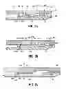 Fig. 06 - Sliding sleeve valve and method for fluid treating a subterranean formation