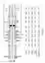 Fig. 05 - MANAGED PRESSURE DRILLING SYSTEM HAVING WELL CONTROL MODE