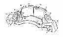 Fig. 01 - Disc brake pad mounting and retention system and method