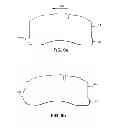 Fig. 07 - Disc brake pad mounting and retention system and method