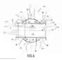 Fig. 04 - Removal device in particular for micro-bubbles, volatile compounds and dirt