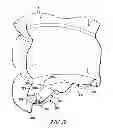Fig. 22 - CONTAINER BASE HAVING VOLUME ABSORPTION PANEL