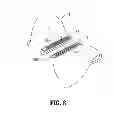 Fig. 06 - BUTTRESS ATTACHMENT FEATURES FOR SURGICAL STAPLING APPARATUS