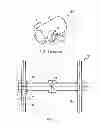 Fig. 02 - Landing gear steering using eccentric bearings