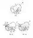 Fig. 03 - Landing gear steering using eccentric bearings