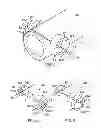 Fig. 04 - Landing gear steering using eccentric bearings