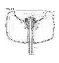 Fig. 07 - Axle mounting assemblies and children's products having axle mounting assemblies