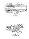 Fig. 02 - Ferrule with internal recess and cylindrical wall