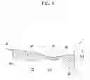 Fig. 04 - Front vehicle body reinforcing structure