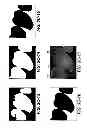 Fig. 09 - Method for identifying a tooth region
