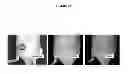 Fig. 03 - Prostate specific antigen agents and methods of using same for prostate cancer imaging