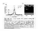 Fig. 09 - VISUALIZATION OF LIPID METABOLISM